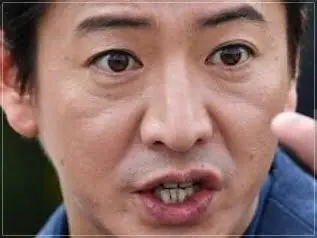 キムタク,木村拓哉,歯,歯並び,画像