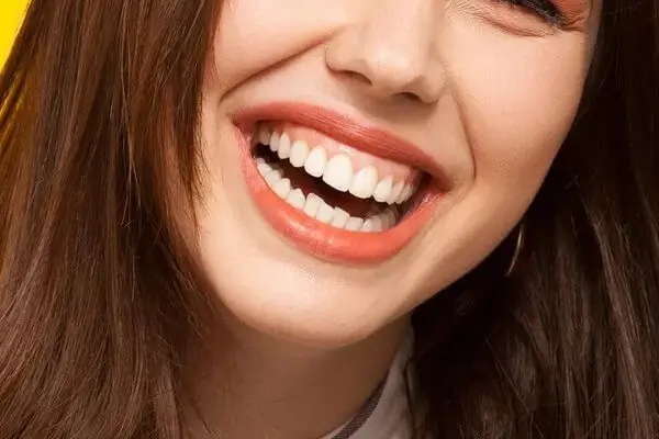 ガミースマイルの芸能人は誰?治し方や原因を調査!可愛いって本当?